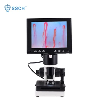 Elektronski mikroskop/ digital microcirculation mikroskop